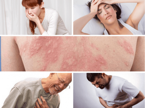 SỐC PHẢN VỆ: NHÌN TỪ CA BỆNH 65 TUỔI
