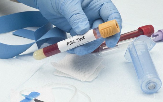 300 tài xế công nghệ được tầm soát ung thư tuyến tiền liệt miễn phí
