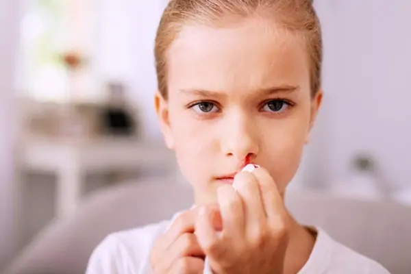 CHẢY MÁU CAM THƯỜNG XUYÊN LÀ BỆNH GÌ?