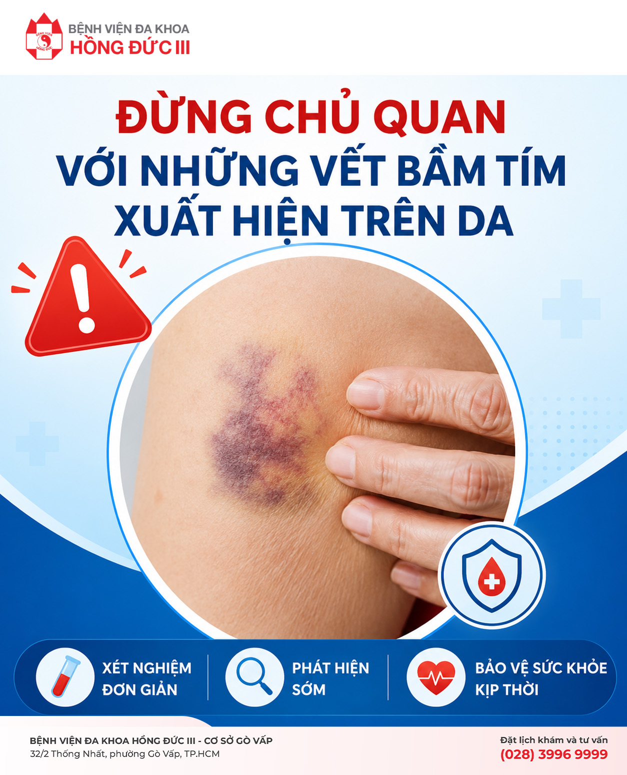 ĐỪNG CHỦ QUAN VỚI NHỮNG VẾT BẦM TÍM XUẤT HIỆN TRÊN DA
