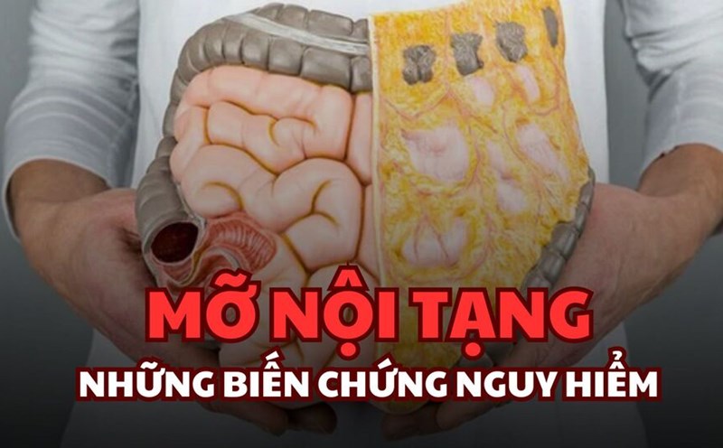 CẢNH GIÁC VỚI MỠ NỘI TẠNG