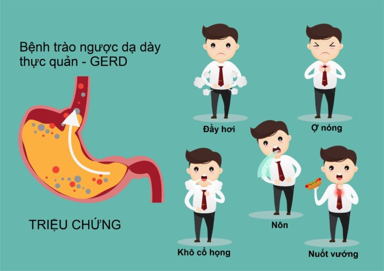 Khổ vì trào ngược dạ dày