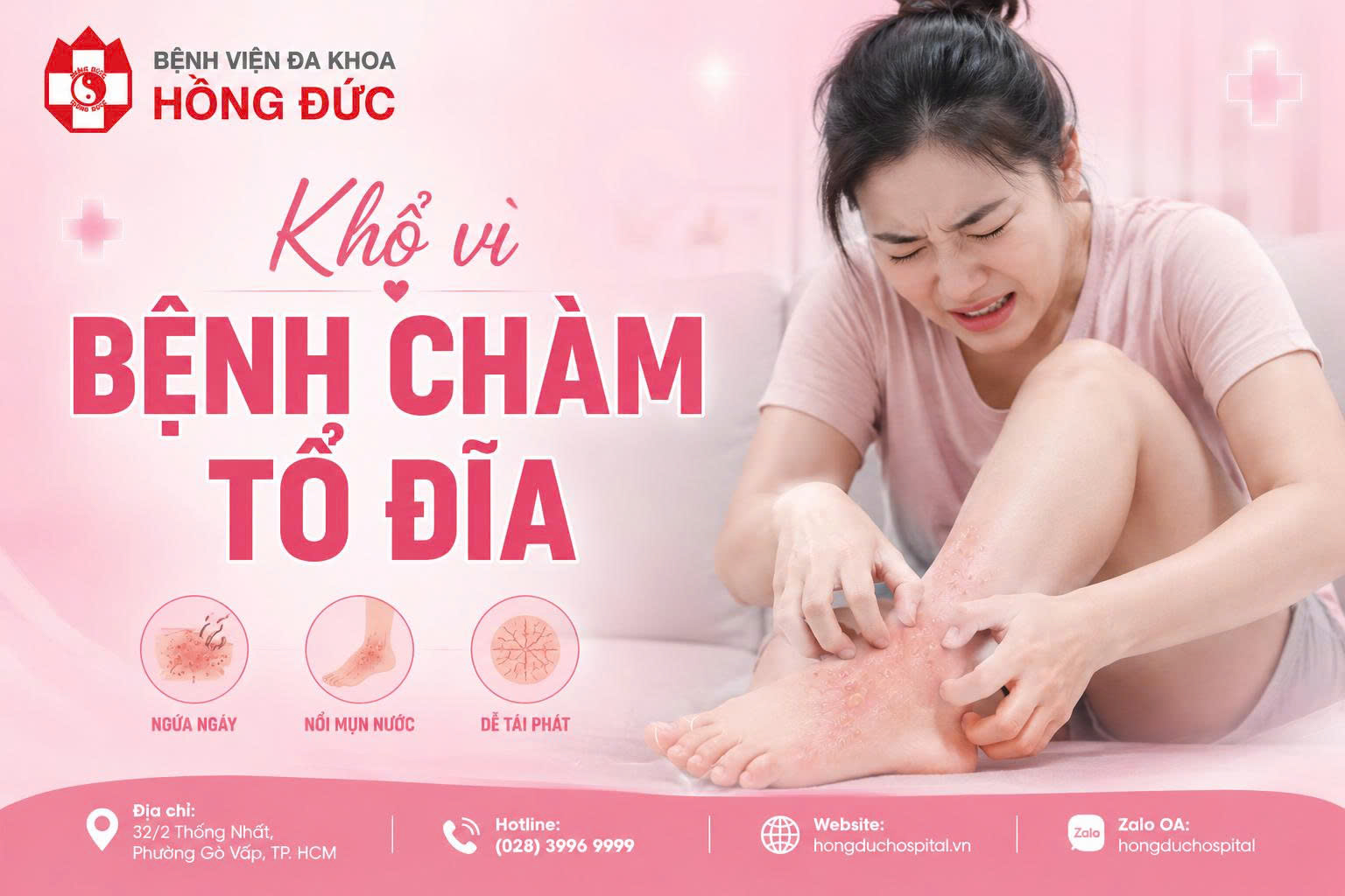KHỔ VÌ BỆNH CHÀM TỔ ĐỈA