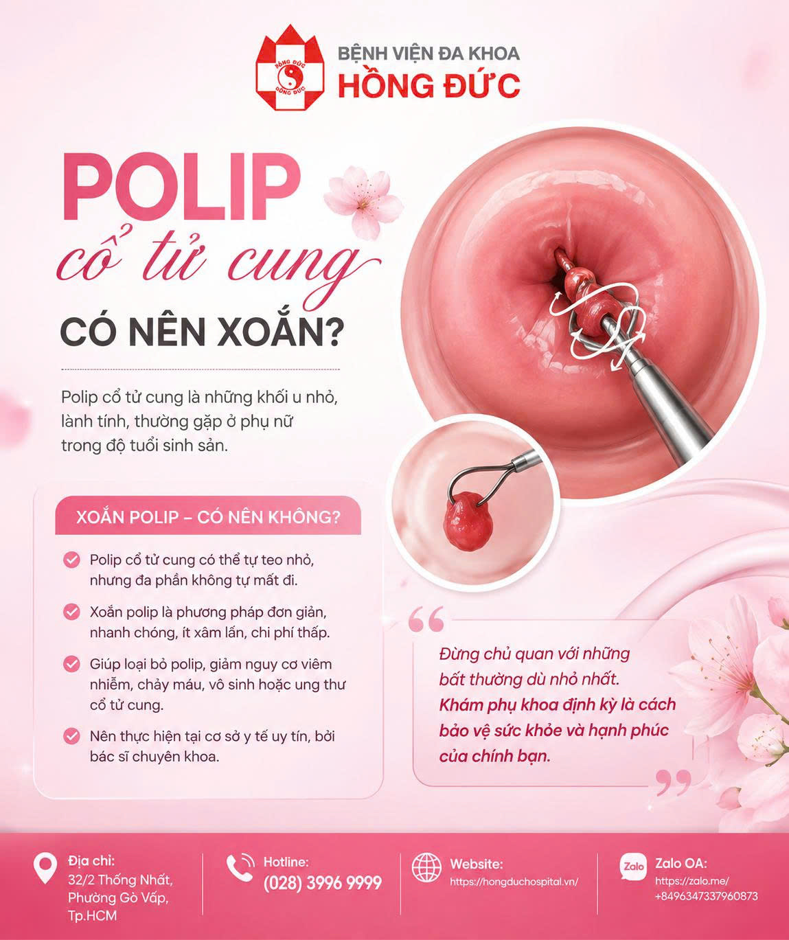 POLYP CỔ TỬ CUNG: CÓ NÊN XOẮN?