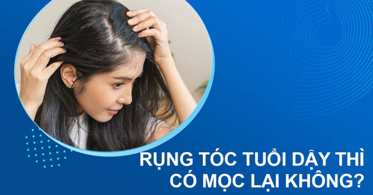 RỤNG TÓC NHIỀU Ở TUỔI DẬY THÌ, PHẢI LÀM SAO?