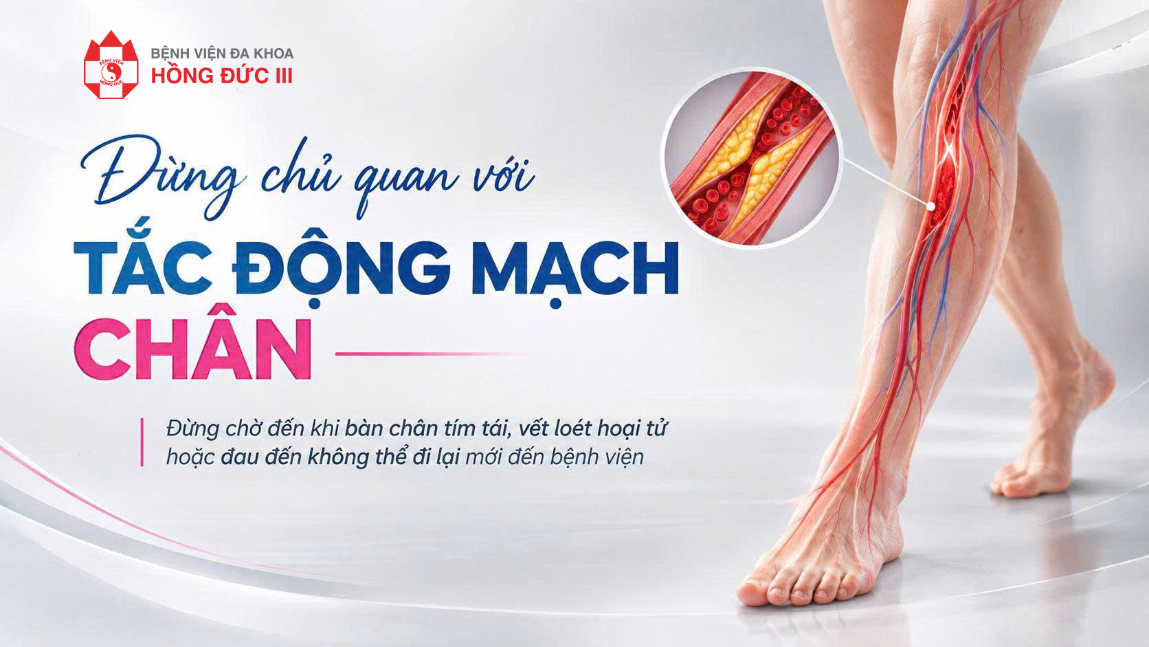ĐỪNG CHỦ QUAN VỚI TẮC ĐỘNG MẠCH CHÂN