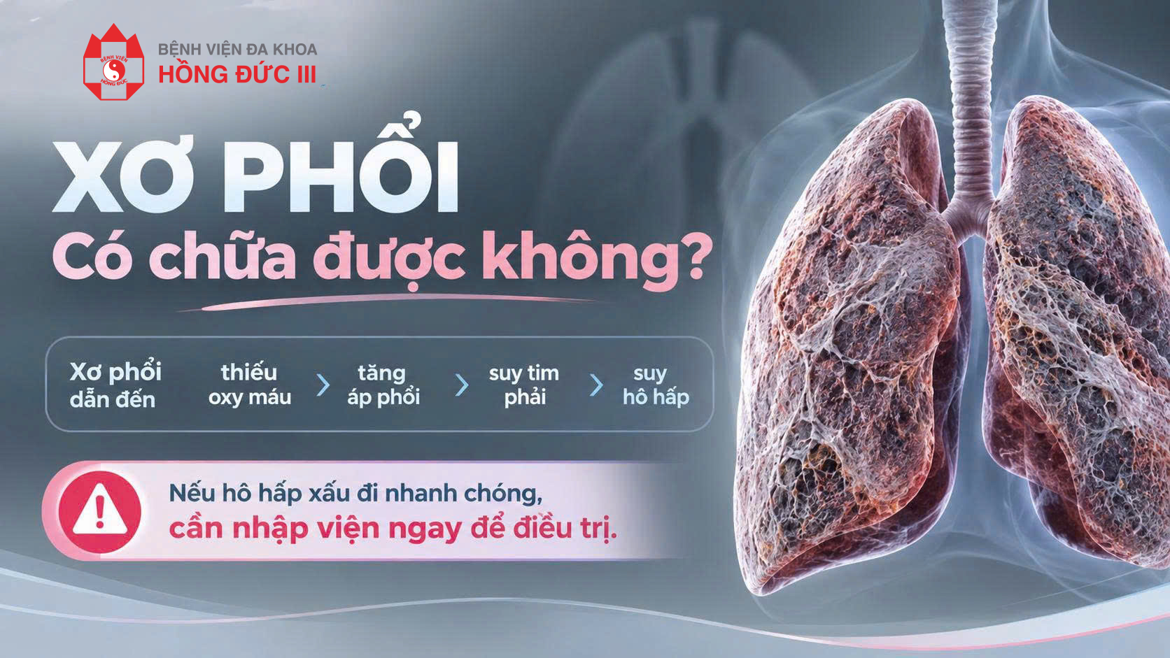 XƠ PHỔI CÓ CHỮA ĐƯỢC KHÔNG?