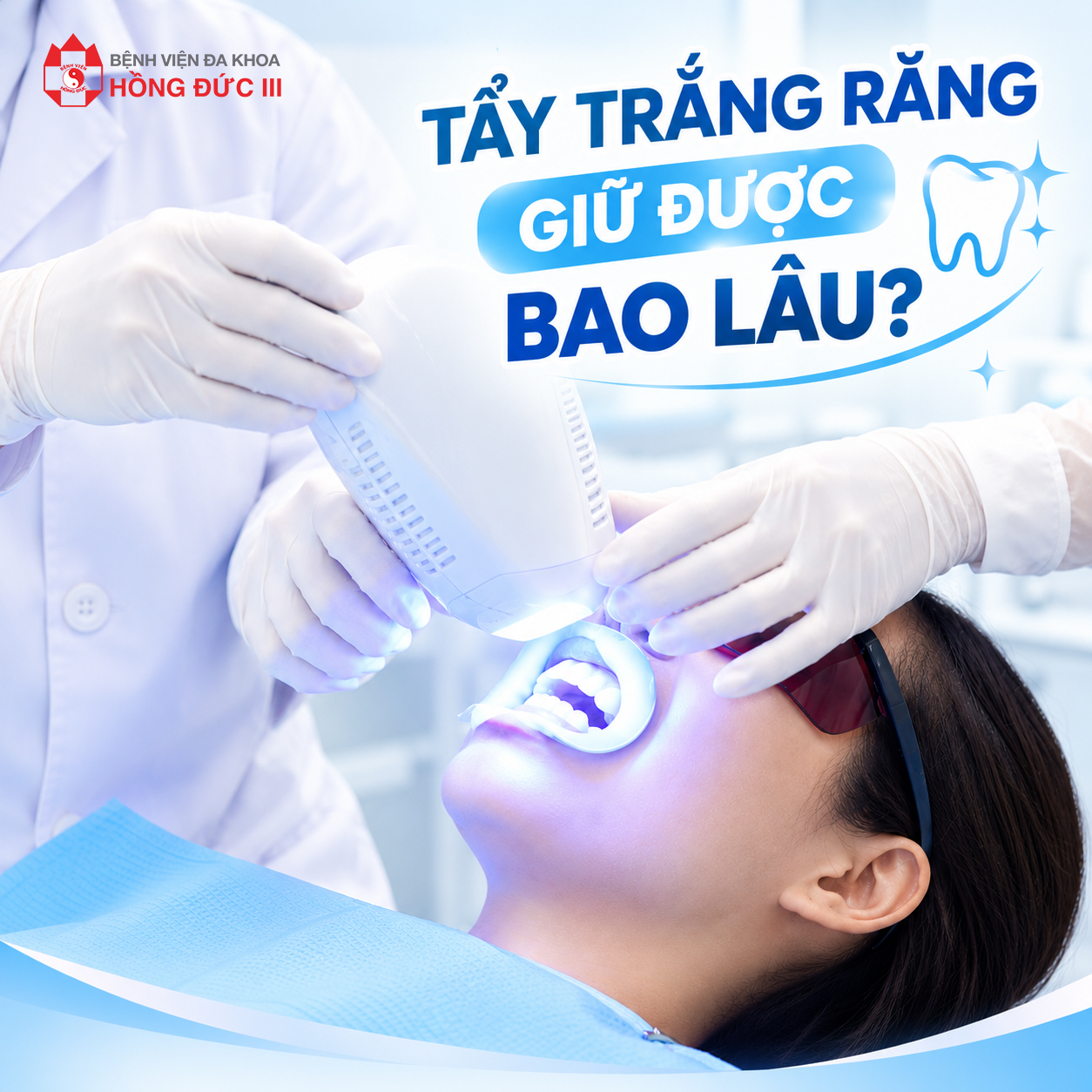 TẨY TRẮNG RĂNG GIỮ ĐƯỢC BAO LÂU?