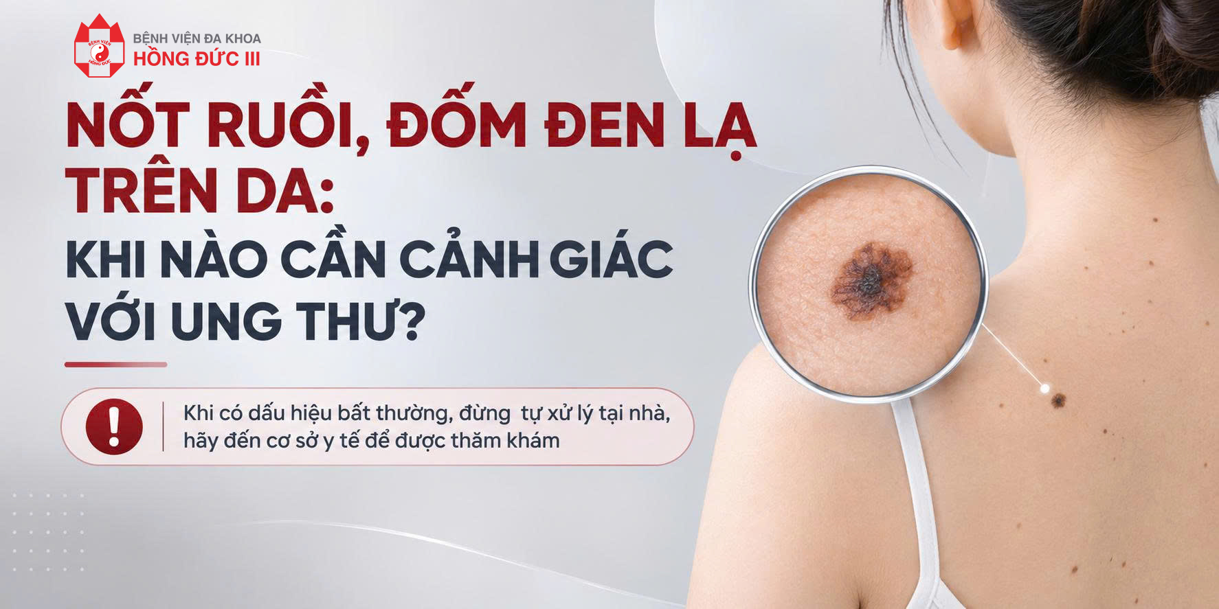 NỐT RUỒI, ĐỐM ĐEN LẠ TRÊN DA: KHI NÀO CẦN CẢNH GIÁC VỚI UNG THƯ?